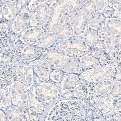 AGER Antibody (CL10587), Novus Biologicals 100 &mu;g; Unconjugated:Antibodies,