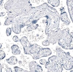 AGER Antibody (CL10587), Novus Biologicals 100 &mu;g; Unconjugated:Antibodies,