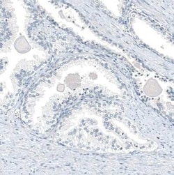 AGER Antibody (CL10587), Novus Biologicals 100 &mu;g; Unconjugated:Antibodies,