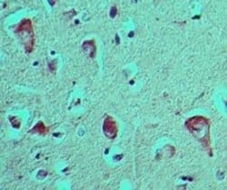 AGER Antibody, Novus Biologicals 0.1 mg; Unconjugated:Antibodies, Polyclonal