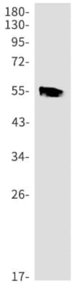 AGER Antibody (S06-2H4), Novus Biologicals 50 &mu;g; Unconjugated:Antibodies,