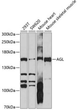 AGL Antibody - BSA Free, Novus Biologicals 0.02 mL, Unconjugated:Antibodies,