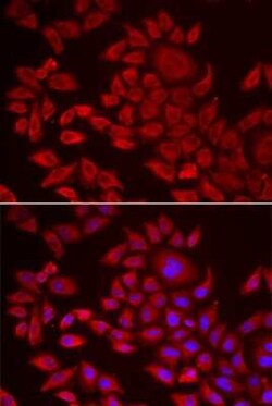 AGPAT2 Antibody - BSA Free, Novus Biologicals 0.02 mL | Buy Online | Novus Biologicals | Fisher Scientific