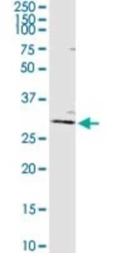 AGPAT2 Antibody, Novus Biologicals 0.1 mg | Buy Online | Novus Biologicals | Fisher Scientific