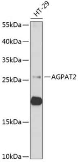 AGPAT2 Antibody - BSA Free, Novus Biologicals 0.02 mL | Buy Online | Novus Biologicals | Fisher Scientific