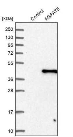 Novus Biologicals AGPAT5 Antibody, Novus Biologicals 0.1 mL; Unconjugated:Antibodies,