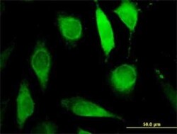 AGPAT6 Antibody (4C12), Novus Biologicals 0.1 mg; Unconjugated:Antibodies,