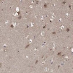 AGPAT7 Rabbit anti-Human, Polyclonal, Novus Biologicals:Antibodies:Primary
