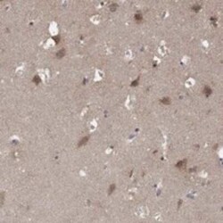 AGPAT7 Rabbit anti-Human, Polyclonal, Novus Biologicals:Antibodies:Primary