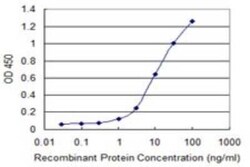 AGTPBP1 Antibody (2B9), Novus Biologicals 0.1 mg | Buy Online | Novus Biologicals | Fisher Scientific