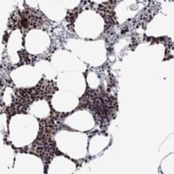 AGTPBP1 Rabbit anti-Human, Polyclonal, Novus Biologicals 25 &mu;g; Unconjugated:Antibodies,