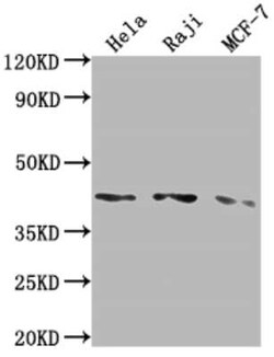 AGTR-1 Antibody (4A9), Novus Biologicals 100 &mu;g; Unconjugated:Antibodies,