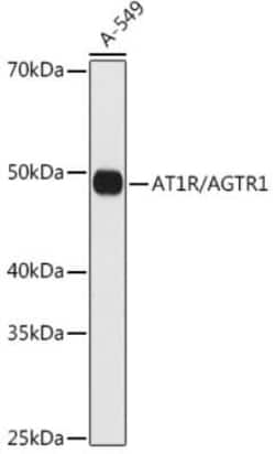 AGTR-1 Rabbit anti-Human, Clone: 8W6G0, Novus Biologicals 20 &mu;g | Buy Online | Novus Biologicals | Fisher Scientific