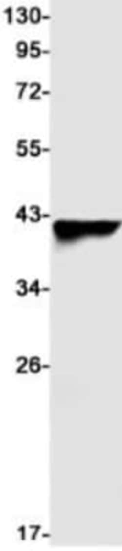 AGTR-1 Antibody (S07-1I6), Novus Biologicals 100 &mu;g; Unconjugated:Antibodies,