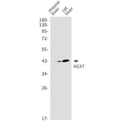 AGXT Antibody (S02-7A4), Novus Biologicals 50 &mu;g; Unconjugated:Antibodies,
