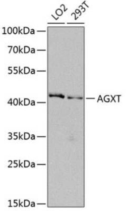 AGXT Antibody - BSA Free, Novus Biologicals 0.02 mL, Unconjugated:Antibodies,
