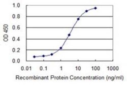 AHCYL1 Antibody (1B3), Novus Biologicals 0.1 mg | Buy Online | Novus Biologicals | Fisher Scientific