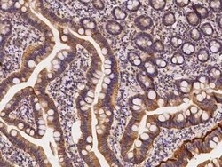AHCYL1 Antibody, Novus Biologicals 50 &mu;g, Unconjugated:Antibodies, Polyclonal
