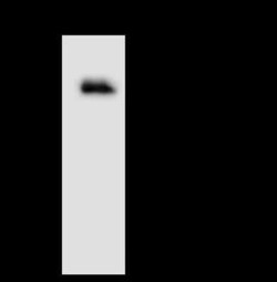 AHCYL1 Antibody, Novus Biologicals 50 &mu;g, Unconjugated:Antibodies, Polyclonal