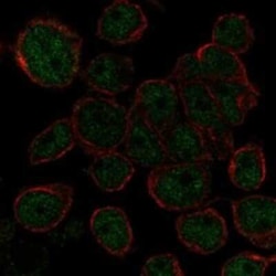 AHDC1 Rabbit anti-Human, Polyclonal, Novus Biologicals 25 &mu;g; Unconjugated:Antibodies,