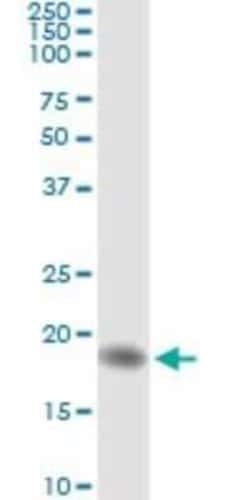 AHNAK Antibody (3G7), Novus Biologicals 0.1 mg; Unconjugated:Antibodies,