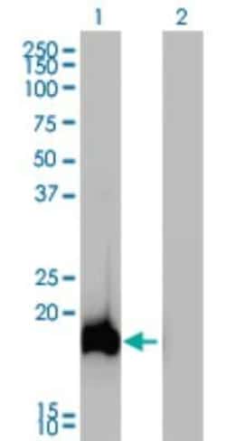 AHNAK Antibody (3G7), Novus Biologicals 0.1 mg; Unconjugated:Antibodies,