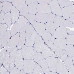 AHNAK2 Antibody, Novus Biologicals 0.1 mL, Unconjugated:Anticuerpos