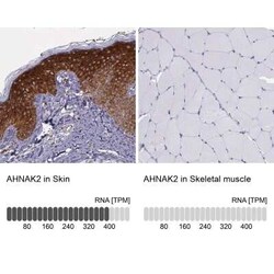 AHNAK2 Antibody, Novus Biologicals 0.1 mL, Unconjugated:Anticuerpos