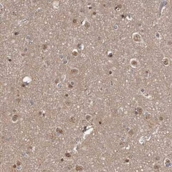 AHR Antibody, Novus Biologicals 25ul; Unconjugated:Antibodies, Polyclonal