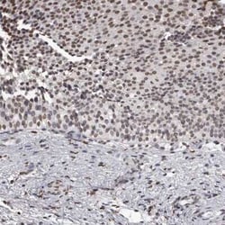 AHR Antibody, Novus Biologicals 0.1 mL; Unconjugated:Antibodies, Polyclonal