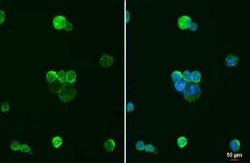 AIF-1/Iba1 Antibody (HL22), Novus Biologicals 100 &mu;g; Unconjugated:Antibodies,