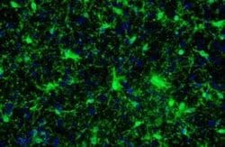 AIF-1/Iba1 Antibody (HL22), Novus Biologicals 100 &mu;g; Unconjugated:Antibodies,