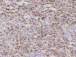 AIF-1/Iba1 Rabbit anti-Human, Clone: 31, Novus Biologicals 50 &mu;g; Unconjugated:Antibodies,