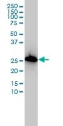 AIF-1/Iba1 Antibody (2A2-B6), Novus Biologicals 0.1 mg | Buy Online | Novus Biologicals | Fisher Scientific