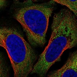 AIF-1/Iba1 Antibody, Novus Biologicals:Antibodies:Primary Antibodies