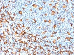 AIF-1/Iba1 Antibody (rAIF1/1909), Novus Biologicals 20 &mu;g; Unconjugated:Antibodies,
