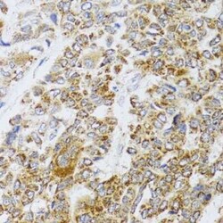 AIFM3 Antibody - BSA Free, Novus Biologicals 0.02 mL, Unconjugated:Antibodies,