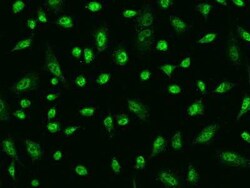 AIM2 Antibody, Novus Biologicals 100 &mu;g | Buy Online | Novus Biologicals | Fisher Scientific