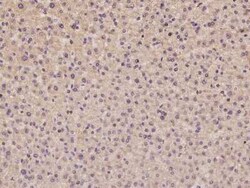 AIM2 Antibody, Novus Biologicals 100 &mu;g | Buy Online | Novus Biologicals | Fisher Scientific