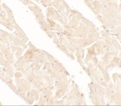 AIMP2 Antibody - BSA Free, Novus Biologicals 0.1 mg | Buy Online | Novus Biologicals | Fisher Scientific