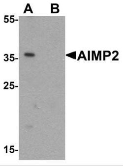 AIMP2 Antibody - BSA Free, Novus Biologicals 0.1 mg | Buy Online | Novus Biologicals | Fisher Scientific