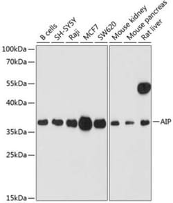 AIP/ARA9 Antibody - BSA Free, Novus Biologicals:Antibodies:Primary Antibodies