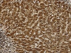 AK2 Rabbit anti-Human, Clone: 25, Novus Biologicals 50 &mu;g; Unconjugated:Antibodies,