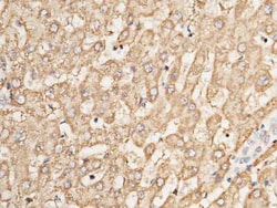 AK2 Antibody, Novus Biologicals:Antibodies:Primary Antibodies