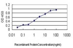 AK3 Antibody (1D2), Novus Biologicals 0.1 mg | Buy Online | Novus Biologicals | Fisher Scientific