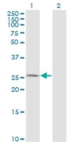 AK3 Antibody (1D2), Novus Biologicals 0.1 mg | Buy Online | Novus Biologicals | Fisher Scientific