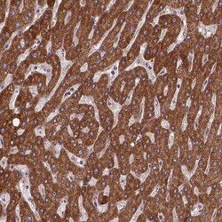 AK3 Antibody, Novus Biologicals 0.1 mL, Unconjugated:Antibodies, Polyclonal