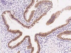 AK3L1 Antibody, Novus Biologicals:Antibodies:Primary Antibodies