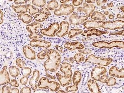 AK3L1 Antibody, Novus Biologicals:Antibodies:Primary Antibodies