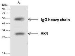 AK3L1 Antibody, Novus Biologicals:Antibodies:Primary Antibodies
